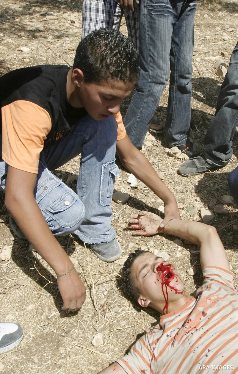 A Palestinian youth lays on the ground after he was hit in the face by a rubber-bullet fired by Israeli troops during a raid in the West Bank city of Nablus. Israeli troops often raid Palestinian communities searching fo...