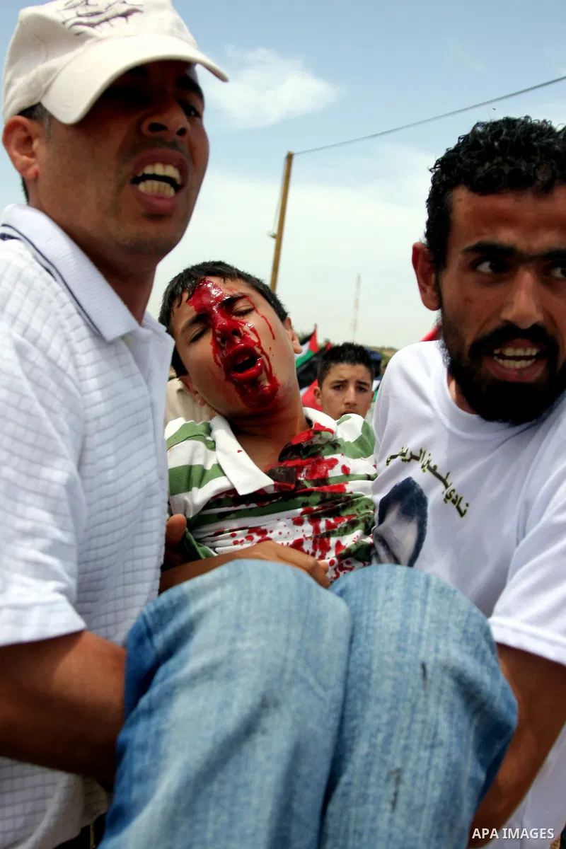 Palestinian men carry a wounded demonstrator during a protest against the Israeli controversial separation barrier in the West Bank village of Bilin near Ramallah ,June 4, 2009. PHOTO/Issam rimawi