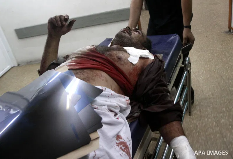 A wounded Palestinian man receives treatment at al-Shifa hospital in Gaza City, July 31, 2010. Israeli war jets struck on Friday night three targets in western Gaza city and in central and southern Gaza Strip, wounding a...