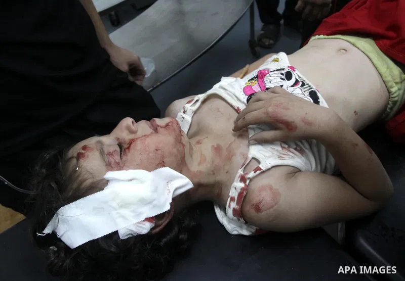 A wounded Palestinian girl receives treatment at al-Shifa hospital in Gaza City, July 31, 2010. Israeli war jets struck on Friday night three targets in western Gaza city and in central and southern Gaza Strip, wounding...