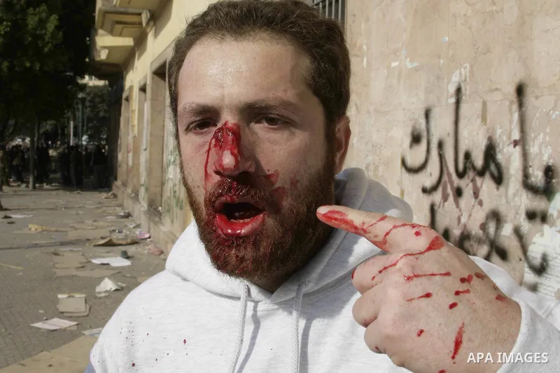 A man lies injured as anti-government protesters clash violently with supporters of President Hosni Mubarak in Tahrir Square in Cairo on 02 February 2011 as Egypt's political upheaval took a dangerous new turn. Photo by...