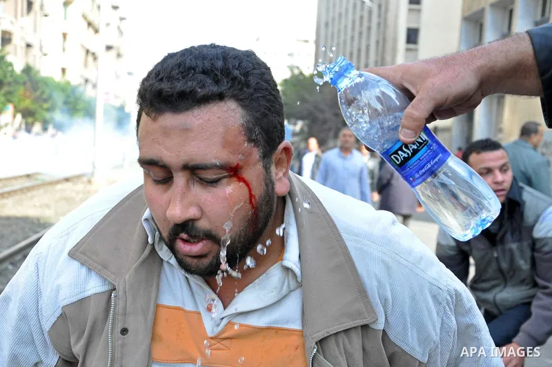 An injured Egyptian protester washes his face with water after police used tear gas during fresh demonstrations that erupted following Friday prayers in Alexandria, Egypt, 28 January 2011. Violent clashes marked a 'Frida...