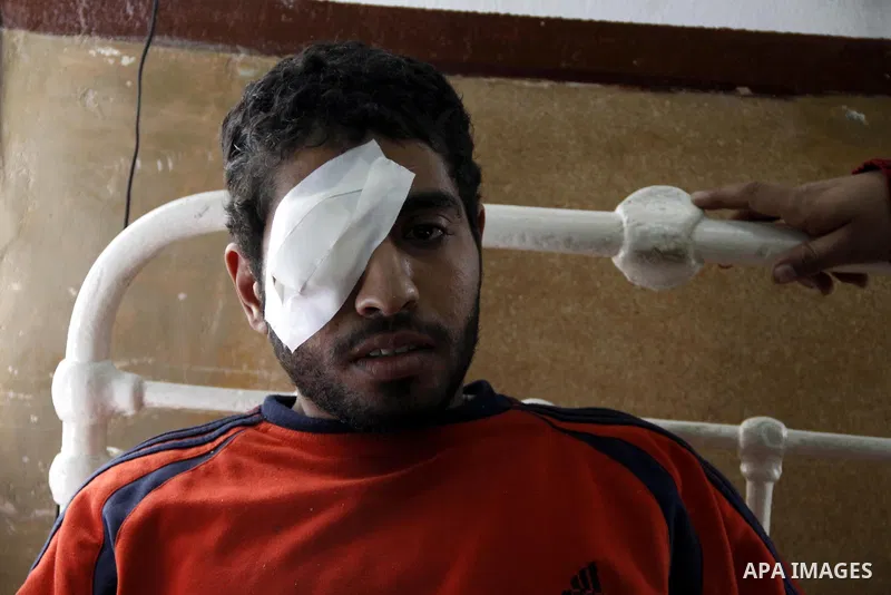 A wounded protester is being treated after being injured during clashes in Cairo's main square, Egypt, Thursday, Feb. 3, 2011. Egyptian army tanks and soldiers moved to end violence between anti-government protesters and...