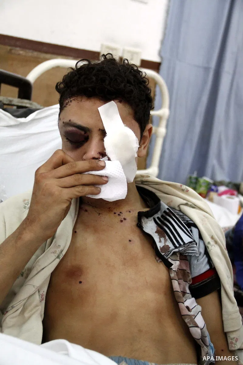 A wounded protester is being treated after being injured during clashes in Cairo's main square, Egypt, Thursday, Feb. 3, 2011. Egyptian army tanks and soldiers moved to end violence between anti-government protesters and...