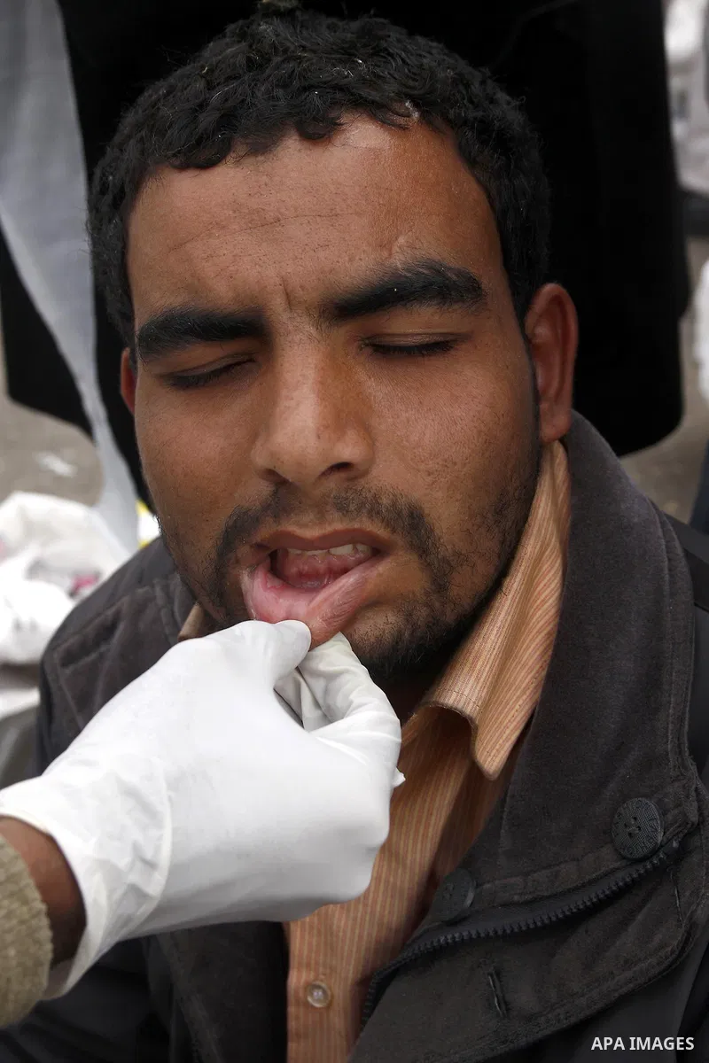 An injured opposition supporter is seen in Tahrir Square in Cairo February 6, 2011. Demonstrators camped out in Cairo's Tahrir Square, which has become an epicentre for protest, vowed to intensify their battle to oust Eg...