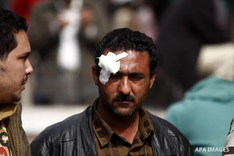 An injured opposition supporter is seen in Tahrir Square in Cairo February 6, 2011. Demonstrators camped out in Cairo's Tahrir Square, which has become an epicentre for protest, vowed to intensify their battle to oust Eg...