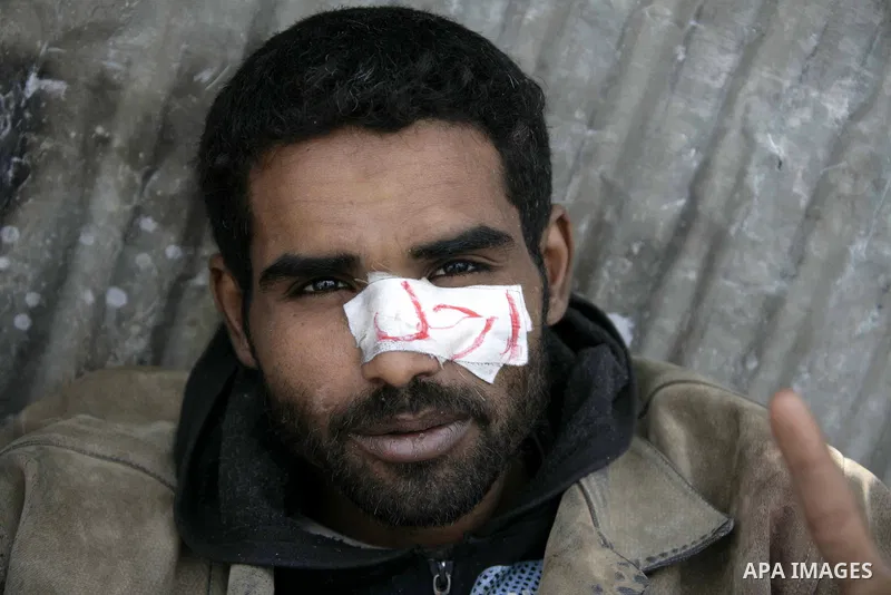 A wounded anti-government protester takes part in demonstrations in Tahrir Square in downtown Cairo, Egypt, Tuesday, Feb. 8, 2011. Protesters appear to have settled in for a long standoff, turning Tahrir Square into a ma...