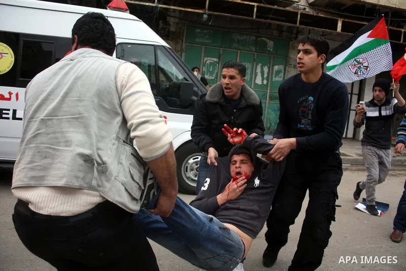 Palestinian medics help wounded Palestinian youths during a protest against the continued closure of Shuhada street to Palestinians, in the West Bank city of Hebron 25 February 2011. The activists gathered on Friday call...