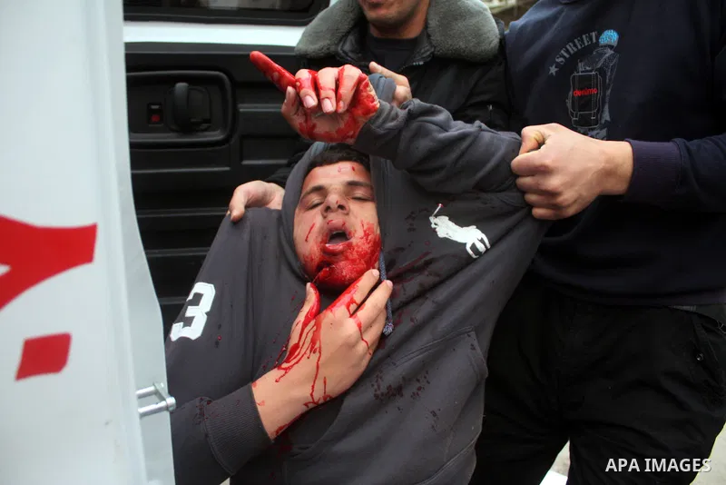 Palestinian medics help wounded Palestinian youths during a protest against the continued closure of Shuhada street to Palestinians, in the West Bank city of Hebron 25 February 2011. The activists gathered on Friday call...