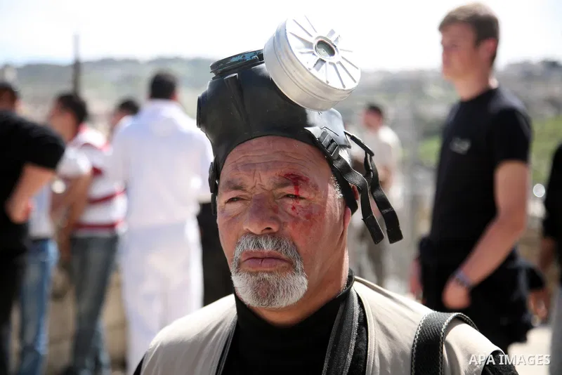 Injury news photographer Mahfouz Abu Turk is seen during the clashes between Israeli soldiers and Palestinian youths after Friday prayers in Jerusalem's neighbourhood of silwan on March 18, 2011. Photo by Sliman Khader