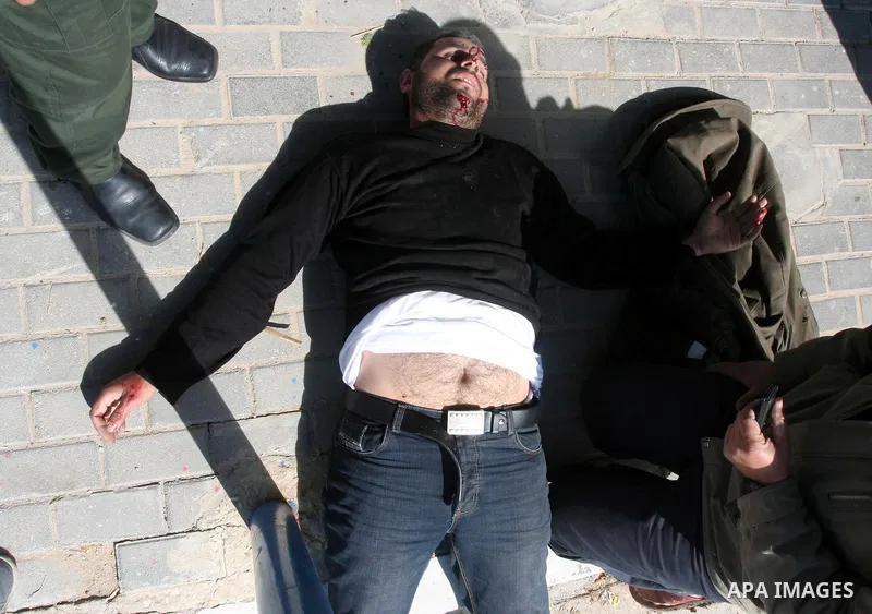 Palestinians gather around an injured man after a tank fired shots toward him in the eastern Gaza city on April 22,2011. Three Palestinians were lightly to moderately wounded when a tank fired at a group of people near t...
