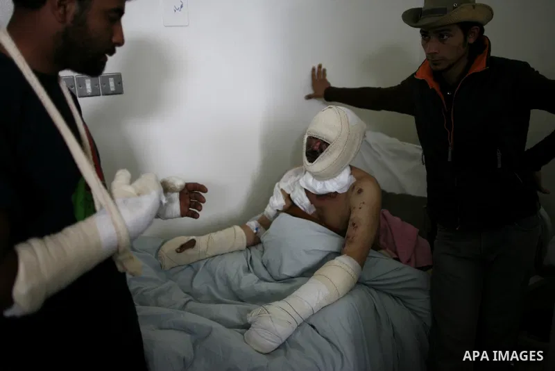 An injured Libyan rebel fighter receives treatment at a hospital after being evacuated from the besieged Libyan city of Misrata at the port in the eastern rebel stronghold of Benghazi on May 13, 2011. A ship carrying inj...