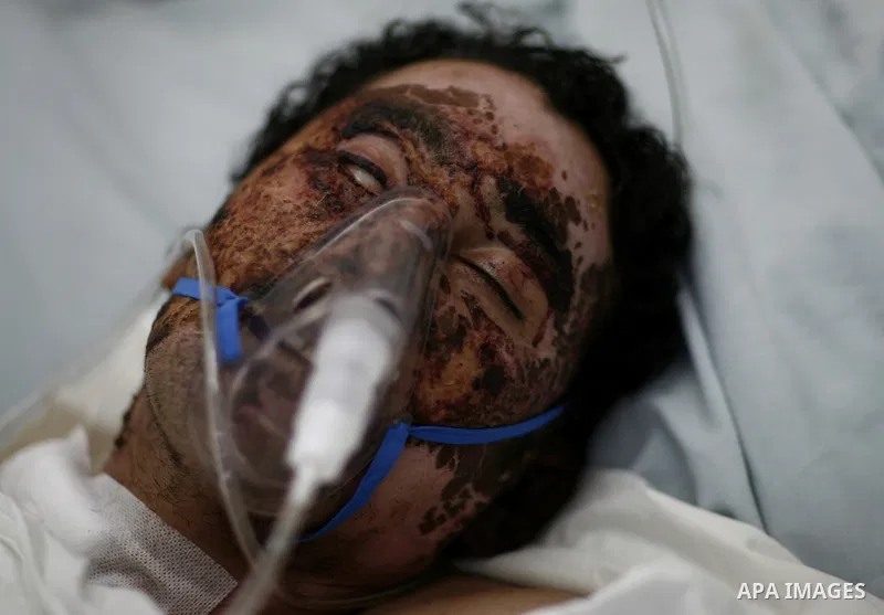 An injured Libyan rebel fighter receives treatment at a hospital after being evacuated from the besieged Libyan city of Misrata at the port in the eastern rebel stronghold of Benghazi on May 13, 2011. A ship carrying inj...