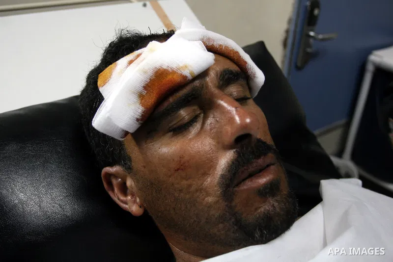 Palestinian man Njajat Maharb 37, From the village of Michmas in Ramallah in the West bank, recieves medical treatment at a hospital in Ramallah on on July 18, 2011. Maharb was apparnetly attacked by Jewish settlers from...