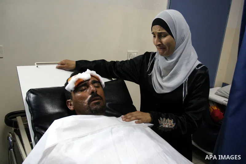 Palestinian man Njajat Maharb 37, From the village of Michmas in Ramallah in the West bank, recieves medical treatment at a hospital in Ramallah on on July 18, 2011. Maharb was apparnetly attacked by Jewish settlers from...