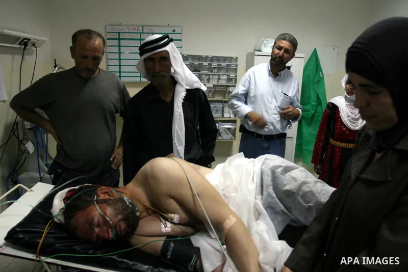 Palestinian man Ahmed Abu Alia 43, From the village of Michmas in Ramallah in the West bank, recieves medical treatment at a hospital in Ramallah on on July 18, 2011. Abu Alia was apparnetly attacked by Jewish settlers f...