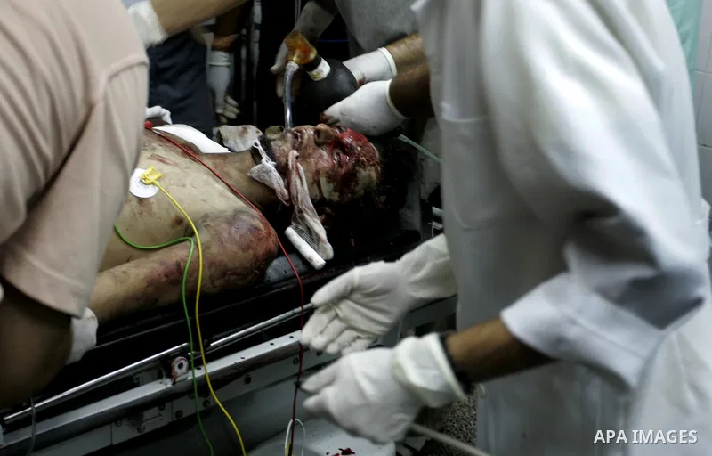 Palestinians doctors attend a wounded man at the Al Najar hospital following an Israeli air strike on a smuggling tunnel in Rafah, southern Gaza Strip, Thursday, Aug. 25, 2011. The Israeli military said its aircraft hit...
