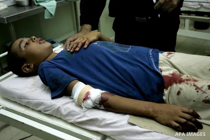 A wounded Palestinian boy receives medical care on September 6, 2011 at a hospital in Khan Yunis, following an Israeli air strike east of the central Gaza Strip city in which a Palestinian militant was killed and three c...