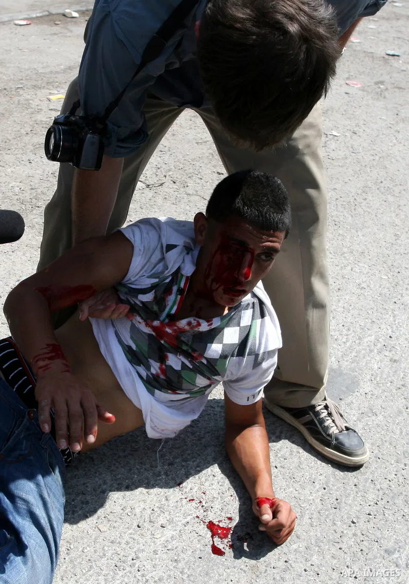 An international activist helps a Palestinian protester, injured in his eye by a tear gas canister fired by Israeli soldiers during clashes at the Qalandia checkpoint between the West Bank city of Ramallah and Jerusalem,...