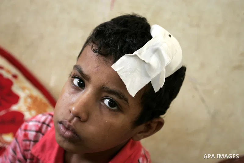 A Palestinian student, Bashir Ghaydah was injured in his head while playing in a school grounds of the Relief and Works Agency refugees "UNRWA" in Rafah, southern Gaza Strip on Sep. 25, 2011. UNRWA refuses to provide tre...