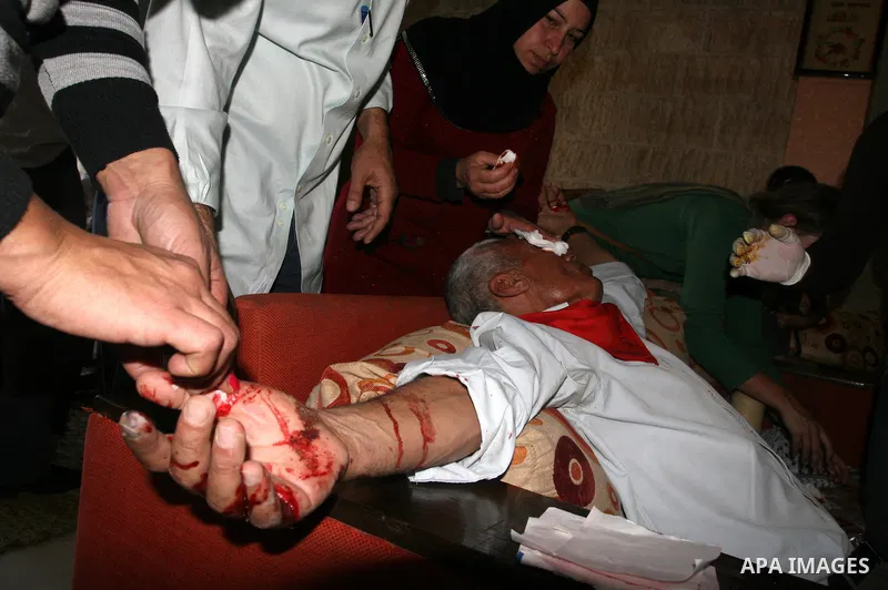 A Palestinian man receives treatment after being wounded by a rubber bullet fired by Israeli soldiers during clashes between Israeli security forces and Palestinian demonstrators at a weekly protest in the West Bank vill...