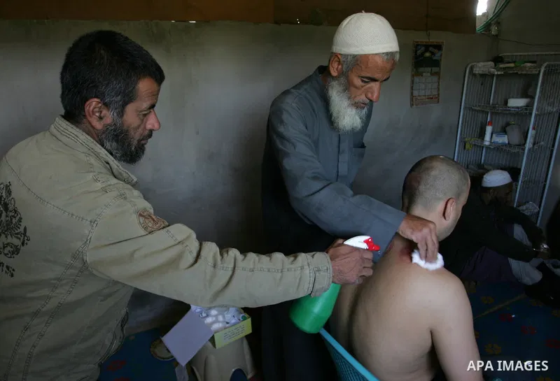 Palestinian therapist Rabhy Abu Jazar treats a patient suffering from backache and headaches using a form of cupping therapy which extracts blood from the patient, at his clinic in the Rafah refugee camp, southern Gaza S...