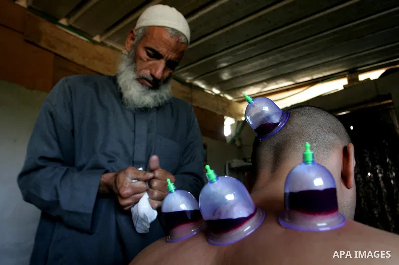 Palestinian therapist Rabhy Abu Jazar treats a patient suffering from backache and headaches using a form of cupping therapy which extracts blood from the patient, at his clinic in the Rafah refugee camp, southern Gaza S...