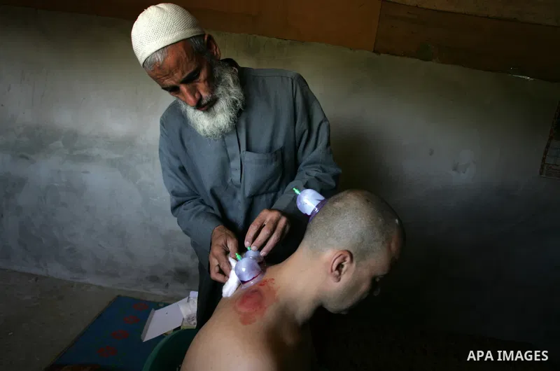 Palestinian therapist Rabhy Abu Jazar treats a patient suffering from backache and headaches using a form of cupping therapy which extracts blood from the patient, at his clinic in the Rafah refugee camp, southern Gaza S...