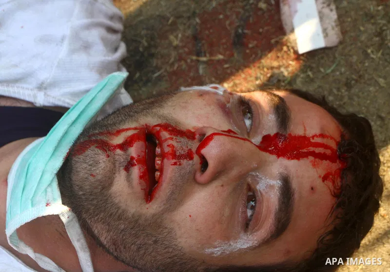 Protesters help another protester injured during clashes with riot police near Tahrir square in Cairo, Egypt, Wednesday, Nov. 23, 2011. Egyptian police are clashing with anti-government protesters for a fifth day in Cair...