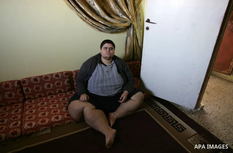 Palestinian Ahmad Salama al-Najjar,21, sits at his family house in the southern Gaza Strip town of Khan Younis on Nov. 28,2011. Al-Najjar suffers from abnormal fatness since five years as a result of Osteoporosis until h...