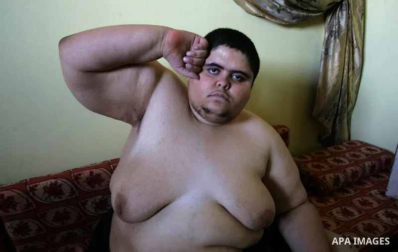 Palestinian Ahmad Salama al-Najjar,21, sits at his family house in the southern Gaza Strip town of Khan Younis on Nov. 28,2011. Al-Najjar suffers from abnormal fatness since five years as a result of Osteoporosis until h...