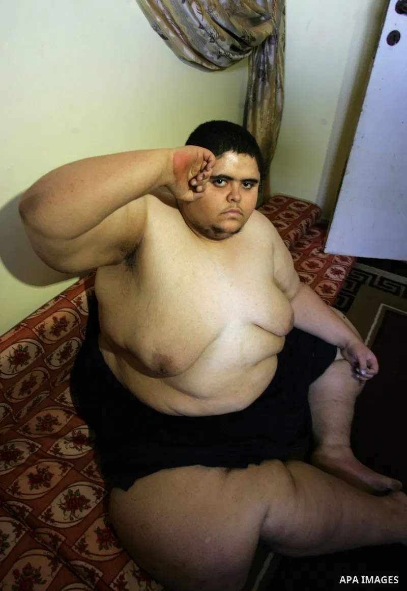Palestinian Ahmad Salama al-Najjar,21, sits at his family house in the southern Gaza Strip town of Khan Younis on Nov. 28,2011. Al-Najjar suffers from abnormal fatness since five years as a result of Osteoporosis until h...