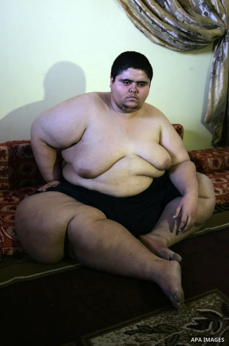 Palestinian Ahmad Salama al-Najjar,21, sits at his family house in the southern Gaza Strip town of Khan Younis on Nov. 28,2011. Al-Najjar suffers from abnormal fatness since five years as a result of Osteoporosis until h...