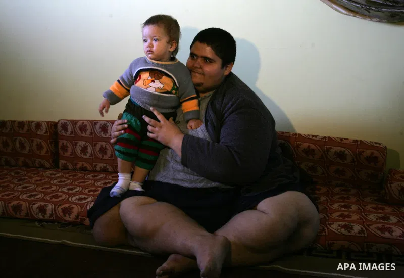 Palestinian Ahmad Salama al-Najjar,21, sits at his family house in the southern Gaza Strip town of Khan Younis on Nov. 28,2011. Al-Najjar suffers from abnormal fatness since five years as a result of Osteoporosis until h...