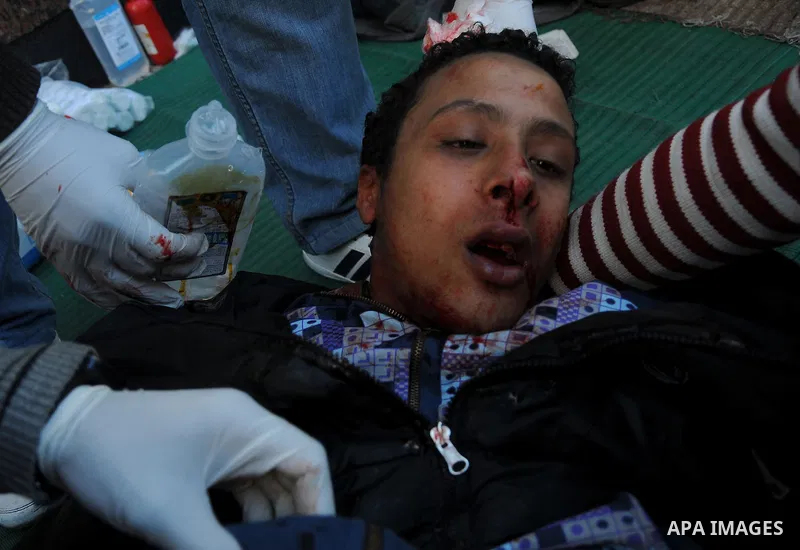 Egyptian medics help a young protester near Tahrir Square in Cairo, Egypt, Sunday, Dec. 18, 2011. Troops and protesters are clashing for the third straight day in Cairo, pelting each other with rocks in skirmishes near p...
