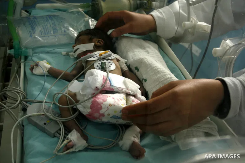 Premature babies receive treatment in the Nasser hospital in Khan Younis, southern Gaza Strip on February 15, 2012 as the hospital suffer from running out of fuel. Palestinian Ministry of Health in Gaza, calls for the Ar...