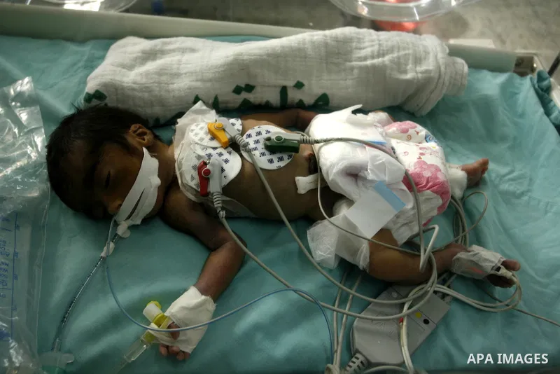 Premature babies receive treatment in the Nasser hospital in Khan Younis, southern Gaza Strip on February 15, 2012 as the hospital suffer from running out of fuel. Palestinian Ministry of Health in Gaza, calls for the Ar...