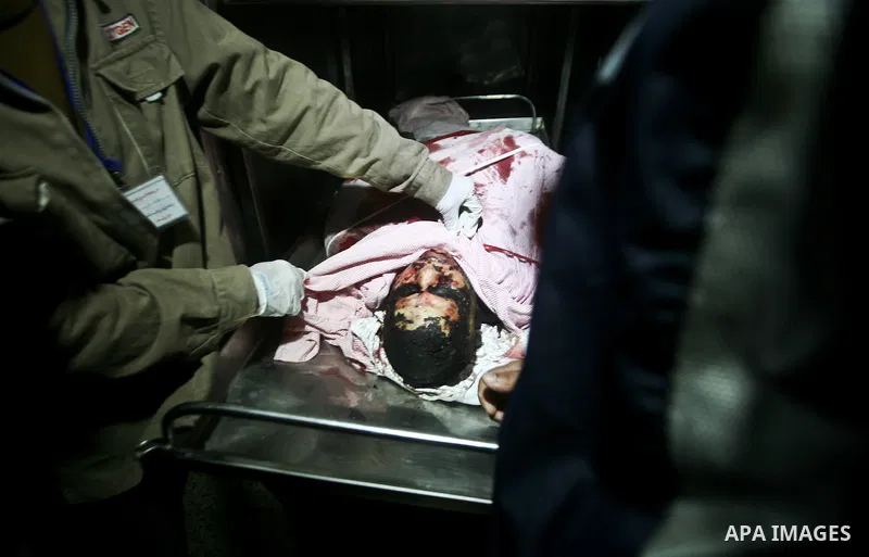 Palestinians look at the body of Mahmud Halani, a member of the Popular Resistance Committees militant group, after he was killed along with the General Secretary of PRC, Zohair al-Qaisi, in an Israeli air strike that ta...