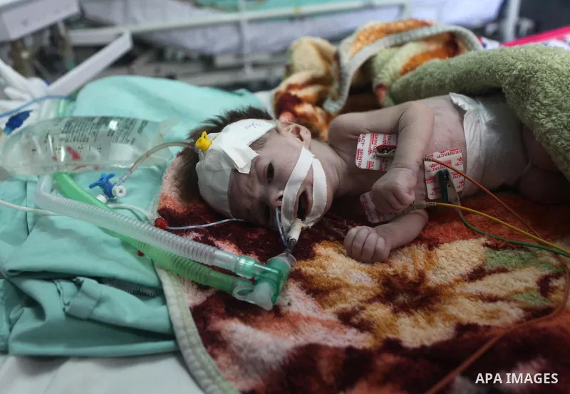 Premature babies receive treatment in the Rantisi hospital for children in Gaza City on Mar. 21, 2012 as the hospital suffer from running out of fuel. Palestinian Ministry of Health in Gaza, calls for the Arab States and...