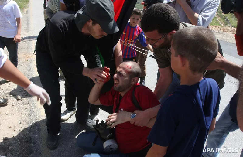 Palestinian local free lance photographer Ahmad Daghlas gets medical help after having been hit in the head by a tear gas grenade being shot by Israeli soldiers, during clashes at the Palestinian weekly Friday protest in...