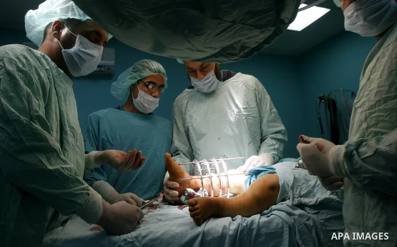 Palestinian doctors perform the first surgery to lengthen a child, "dwarf" in Abu Yousef Al Najjar hospital in Rafah city in the southern Gaza Strip, on April,15, 2012. Photo by Eyad Al Baba
