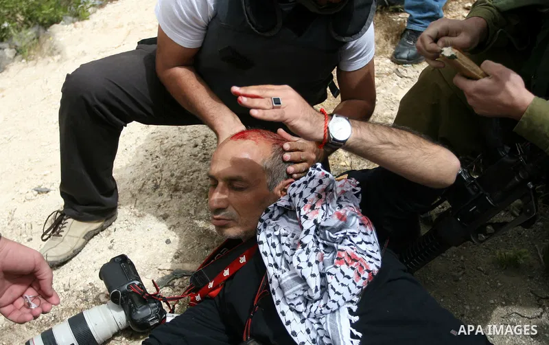 A Palestinian journalist Photographer injured in clashes between israeli military, and palestinian protesters outside Ofer prison near the West Bank city of Ramallah May 1, 2012. The clashes broke out following a protest...