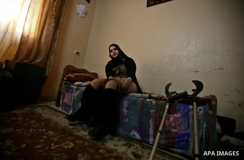 Jamela Al-Habash, a 17-year-old Palestinian girl who lost her legs, sits on her bed with her artificial limbs ready to be put on before leaving her family's home in the Jabaliya refugee camp in the Gaza Strip, 03 May 201...