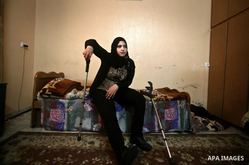 Jamela Al-Habash, a 17-year-old Palestinian girl who lost her legs, sits on her bed with her artificial limbs ready to be put on before leaving her family's home in the Jabaliya refugee camp in the Gaza Strip, 03 May 201...