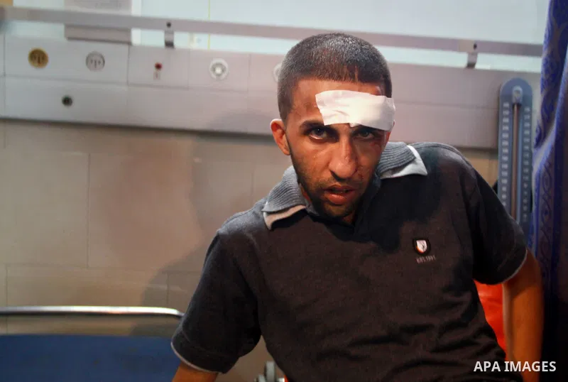 A Palestinian man waits for check up at a hospital in Gaza City on May 17, 2012, following Israeli shelling into the Gaza Strip in which seven people were wounded, two of them in critical condition, near the Karni crossi...