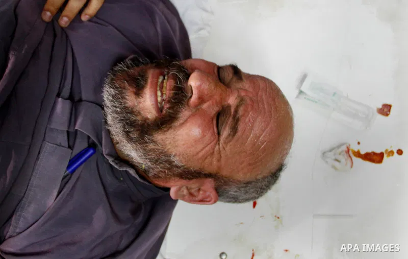 A Palestinian man waits for check up at a hospital in Gaza City on May 17, 2012, following Israeli shelling into the Gaza Strip in which seven people were wounded, two of them in critical condition, near the Karni crossi...