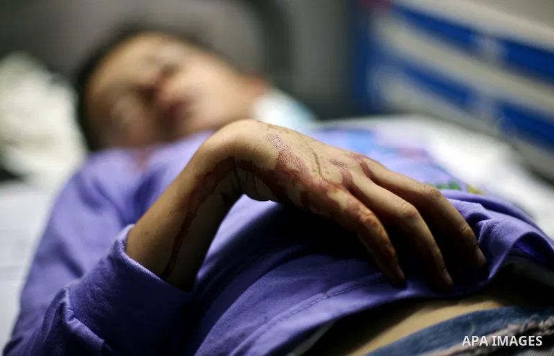 A Palestinian boy wounded by Israeli air strikes on Gaza City on June 20, 2012. There was no let-up in rocket fire from Gaza with at least 10 hitting the Jewish state despite seven Israeli air strikes overnight, police a...