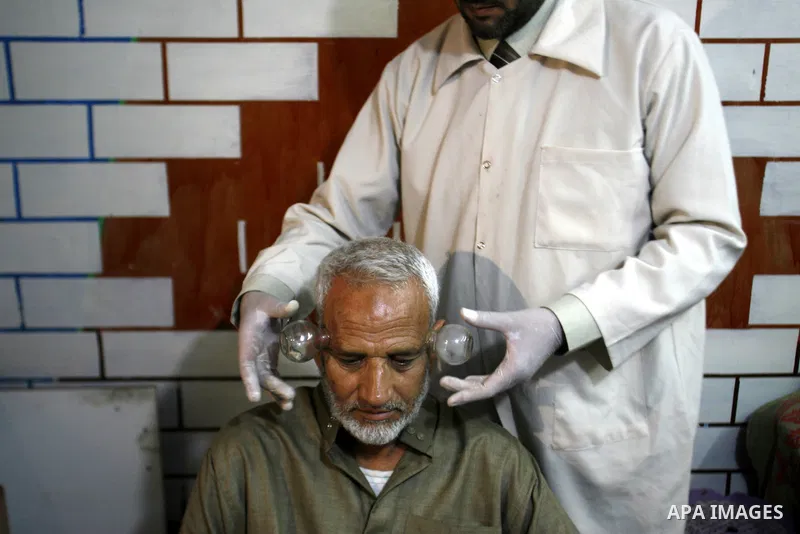 Anwar Sheikh-Eid, 42, performs Hijama or cupping therapy, to Palestinian patient Musa Sheikh El Eid at his shop in the southern Gaza Strip city of Rafah on 27 June 2012. Cupping is an ancient form of alternative medicine...