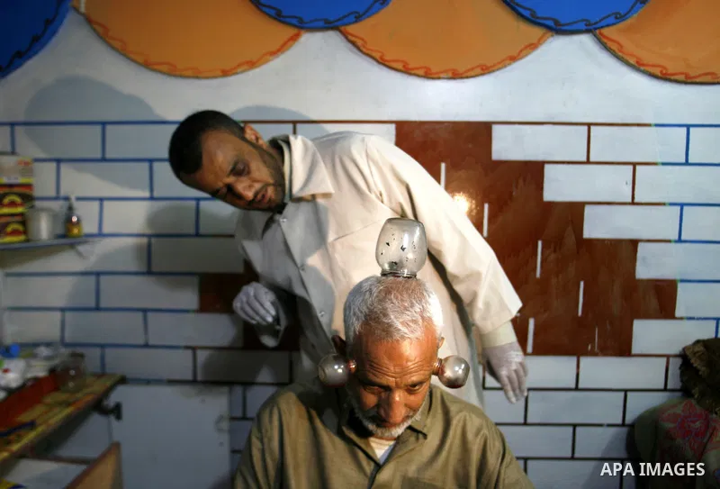 Anwar Sheikh-Eid, 42, performs Hijama or cupping therapy, to Palestinian patient Musa Sheikh El Eid at his shop in the southern Gaza Strip city of Rafah on 27 June 2012. Cupping is an ancient form of alternative medicine...