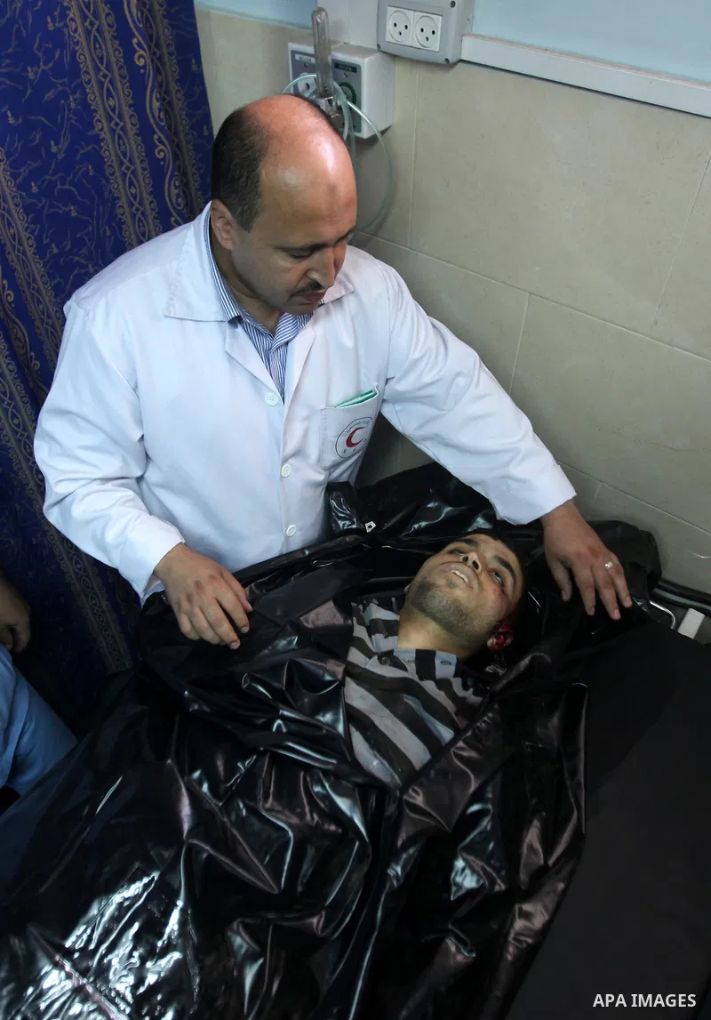 Palestinian medics wheel a Hamas militant into al-Shifa Hospital following an Israeli attack in Gaza City on July 12, 2012. A Palestinian militant from the ruling Hamas movement was killed and two others wounded on Thurs...